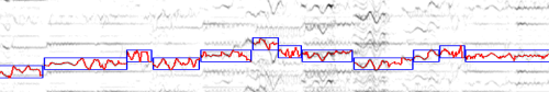 FundamentalFrequency